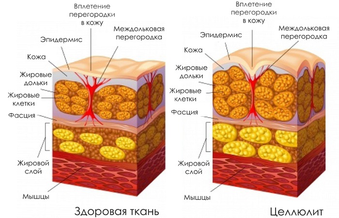 Диагнозы–мифы_003